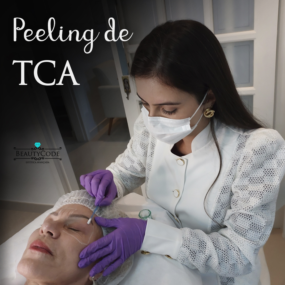 Peeling TCA